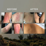 Sven's Island Miracle Manuka Skin Balm (choose size)